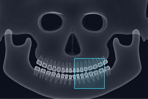 FOV 4 x 4 image 3